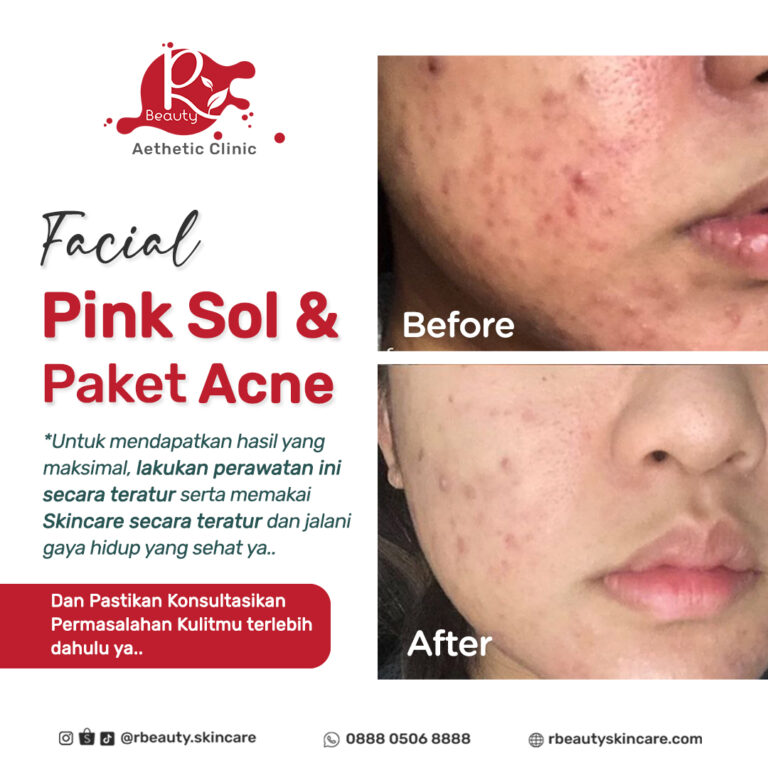 07 09 BA FACIAL PINK SOL