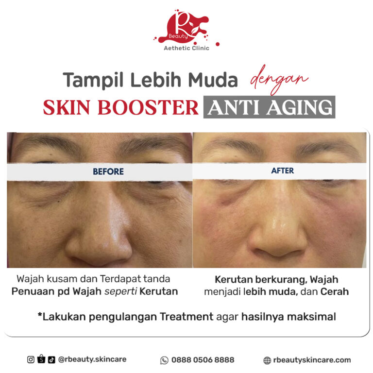 07 10 BA SKIN BOOSTER ANTI AGING