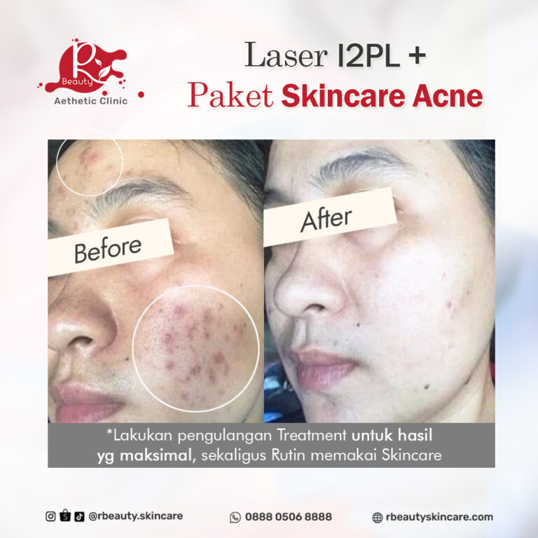 07 12 BA I2PL dan PRODUK