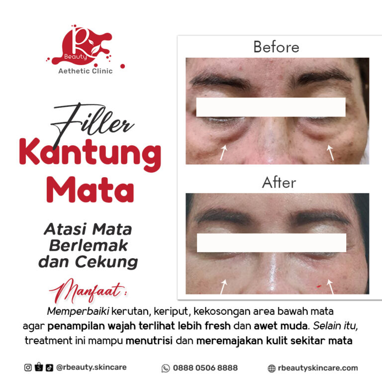 14 11 BA FILLER KANTUNG MATA