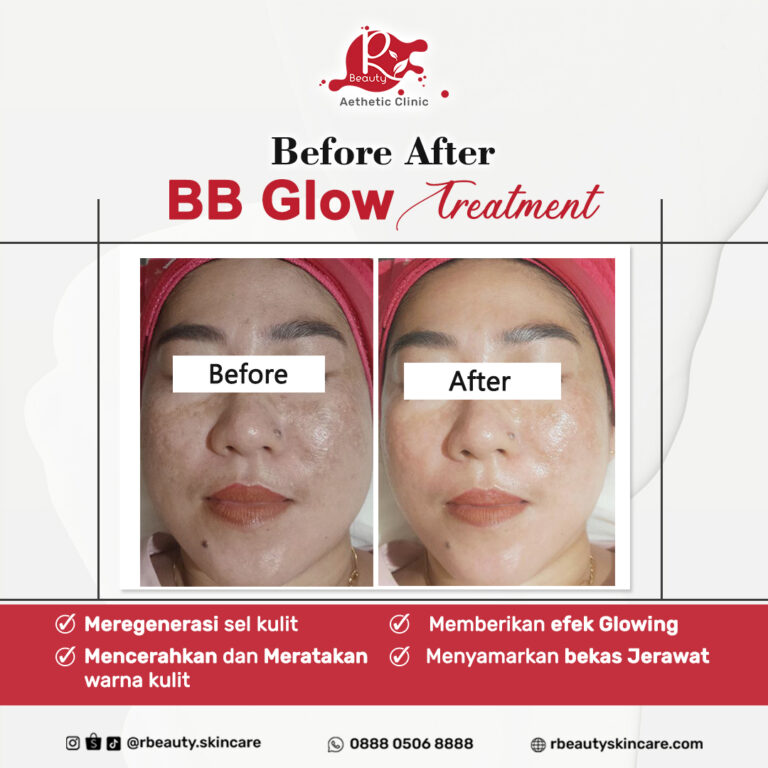 23 11 BA BB GLOW